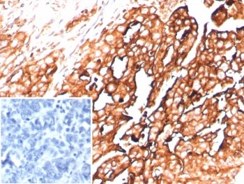 Mesothelin Antibody / MSLN