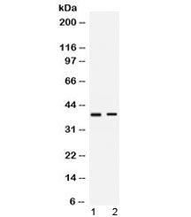 LIGHTR Antibody / TNFRSF14 / HVEM