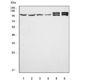 Western blot testing of 1) human HeLa, 2) human MCF7, 3) human RT4, 4) human U-251, 5) rat brain and
