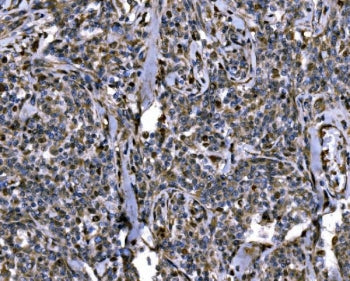 KPNA2 Antibody
