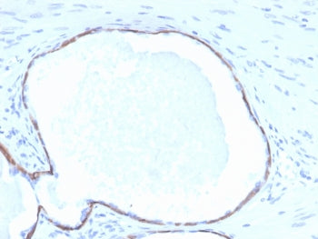 IHC staining of FFPE human prostate tissue with Cytokeratin 14 antibody (clone KRT14/4132). HIER: boil tissue sections in pH 9 10mM Tris with 1mM EDTA for 20 min and allow to cool before testing.
