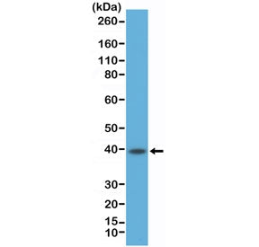 Western blot testing of human Raji cell lysate with recombinant CD23 antibody at 1:500 dilution. Exp