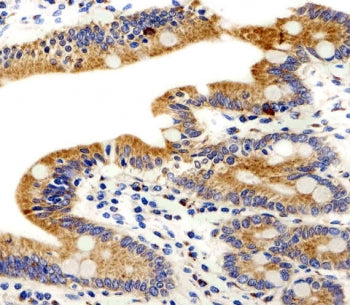 IHC testing of FFPE human small intestine tissue with ADRA1D antibody. HIER: steam section in pH6 ci