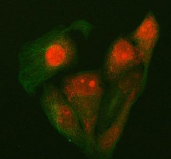Immunofluorescent staining of FFPE human HeLa cells with P15RS antibody (red) and Alpha Tubulin mAb 