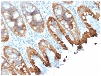 IHC staining of FFPE human colon tissue with recombinant Cytokeratin 8/18 antibody (clone rKRT8.18/1