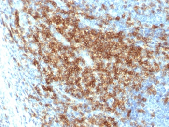 IHC testing of FFPE human tonsil with recombinant CD43 antibody (clone SPN/2049R). Required HIER: bo
