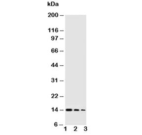 Western blot testing of NGF antibody and Lane 1: Recombinant human protein 10ng; 2: 5ng; 3: 2.5ng
