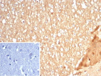 IHC staining of FFPE human brain tissue with S100A5 antibody (clone S100A5/7472). Inset: PBS used in