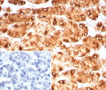 IHC staining of FFPE human stomach tissue with Blood Group Lewis y antibody (clone LWY/9243R). Inset