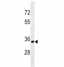 Anti-CD20 antibody western blot analysis in Ramos lysate.