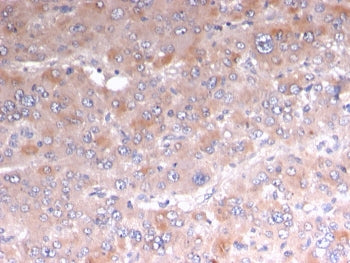 IHC staining of FFPE human adrenal tissue with recombinant Adipophilin antibody (clone rADFP/1493). 