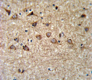 IHC testing of FFPE human brain tissue with Mitoferrin-1 antibody. HIER: steam section in pH6 citrat