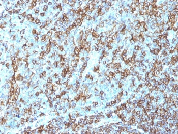 IHC staining of FFPE human tonsil tissue with HLA-DR antibody (clone LN3). HIER: boil tissue section