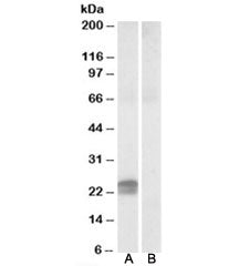 HMGA1 Antibody