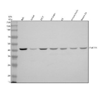 Western blot analysis of TMEFF1 using anti-TMEFF1 antibody. Electrophoresis was performed on a 10% S