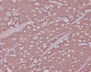 IHC staining of FFPE mouse brain tissue with Synaptophysin antibody. HIER: boil tissue sections in p