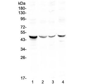 Western blot testing of human 1) HeLa 2) COLO320, 3) SW620 and 4) HepG2 lysate with Caspase 4 antibo