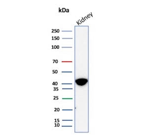 Western blot testing of human kidney tissue lysate with AMACR antibody (clone AMACR/8350R). Predicte