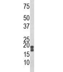 Acid Phosphatase Antibody / ACP1