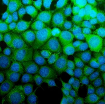 ASS1 Antibody / Argininosuccinate synthetase 1