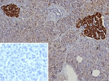 IHC staining of FFPE human pancreas tissue with recombinant CgA antibody (clone rCHGA/9612). Inset: 