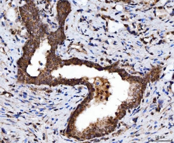 TARBP2 Antibody / TRBP