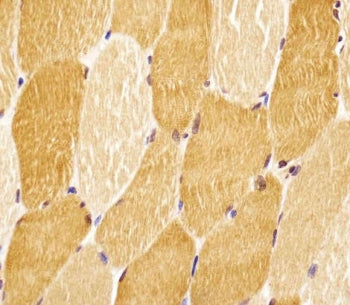 SLC29A2 Antibody