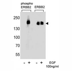 Western blot analysis of extracts from A431 cells, untreated or treated with EGF (100ng/ml), using p