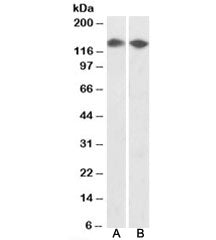 Western blot testing of HEK293 [A] and MCF7 [B] nuclear lysates with DBC1 antibody at 0.5ug/ml. Pred
