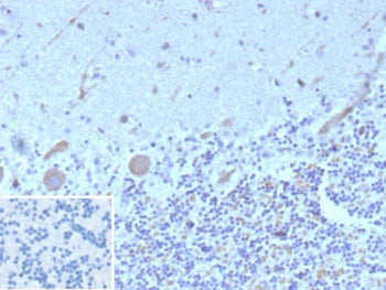 IHC staining of FFPE human brain tissue with FLT3 antibody (clone FLT3/9884). Inset: PBS used in pla
