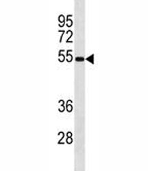 Ips-1 antibody western blot analysis in mouse spleen tissue lysate. Predicted molecular weight: 51-5