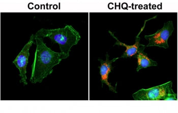 ICC staining of human HeLa cells untreated or treated with chloroquine (CHQ), with recombinant LC3B 