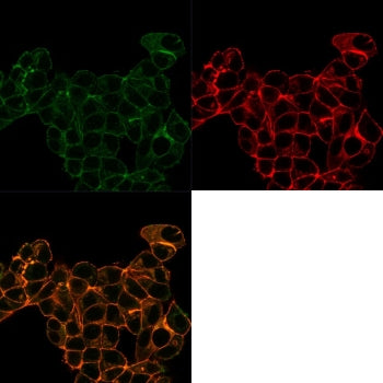 Immunofluorescent staining of PFA-fixed human MCF-7 cells with Lactotransferrin antibody (Green, clo
