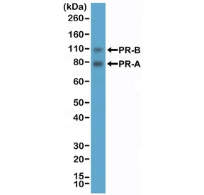 Western blot testing of human T-47D cell lysate with recombinant PR antibody at 1:2000 dilution. Exp