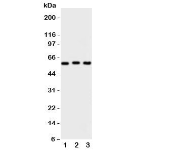Western blot testing of PKM2 antibody and Lane 1: HeLa; 2: MCF-7; 3: A549 cell lysate. Predicted mol