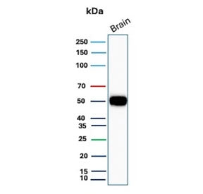 Western blot testing of human brain tissue with GFAP antibody. Predicted molecular weight ~50 kDa.
