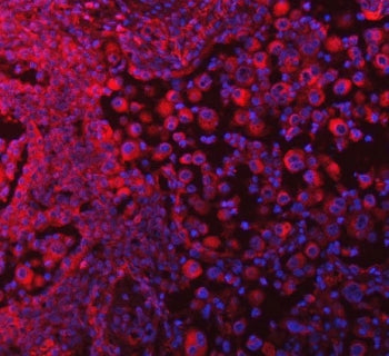 SELT Antibody / SELENOT