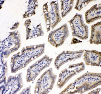 IHC staining of FFPE mouse colon tissue with TNF Receptor antibody. HIER: boil tissue sections in pH