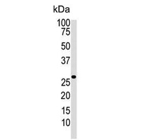 Western blot testing of human Jurkat cell lysate with Dickkopf-2 antibody. Expected molecular weight