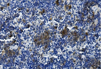 IHC staining of FFPE mouse spleen with Tigit antibody. HIER: boil tissue sections in pH8 EDTA for 20