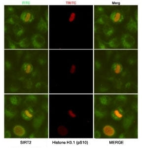 ICC/IF analysis of HeLa cells, fixed fixed by anhydrous methanol at -20oC, using SIRT2 antibody at 1