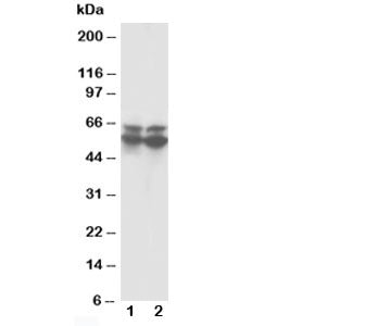 Western blot testing of RUNX2 antibody and Lane 1: rat thymus; 2: rat testis tissue lysate. Predicte