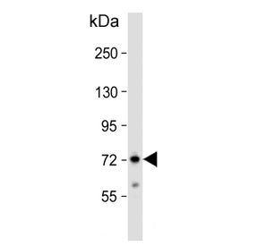 Western blot testing of human Jurkat cell lysate with ZFP823 antibody. Predicted molecular weight ~7