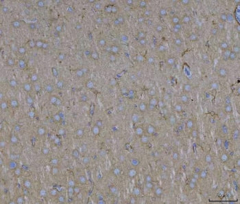 ADAM22 Antibody