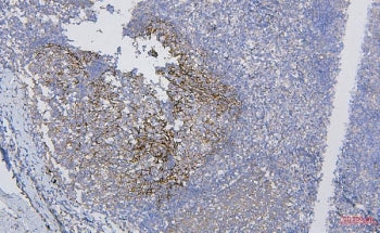 IHC staining of FFPE human tonsil with CD35 antibody. HIER: boil tissue sections in pH8 EDTA for 20 