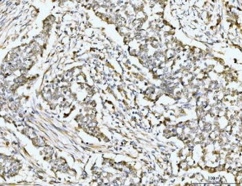 RSKB Antibody / MSK2 / RPS6KA4