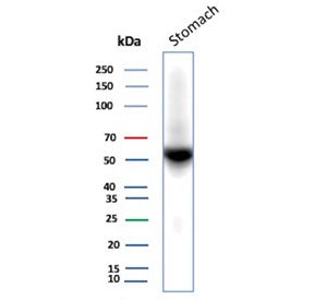 Western blot testing of human stomach tissue lysate with recombinant CA9 antibody (clone rCA9/9937).