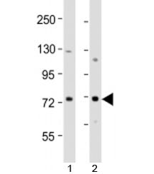 Western blot testing of human 1) MCF-7 and 2) T47D cell lysate with ERVK-9 antibody at 1:2000. Predi