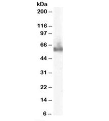 Western blot testing of human PBMC lysate with DOK3 antibody at 0.1ug/ml. Predicted molecular weight