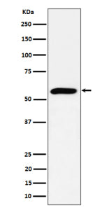 Western blot analysis of PRPF4 expression in HeLa cell lysate using PRPF4 antibody. Predicted molecu